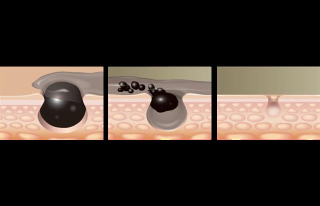 201608011232006946922I2xl